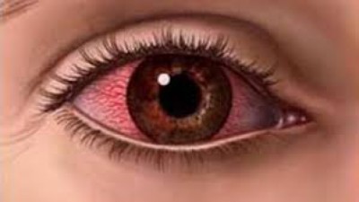 Eye-1529241109.jpg