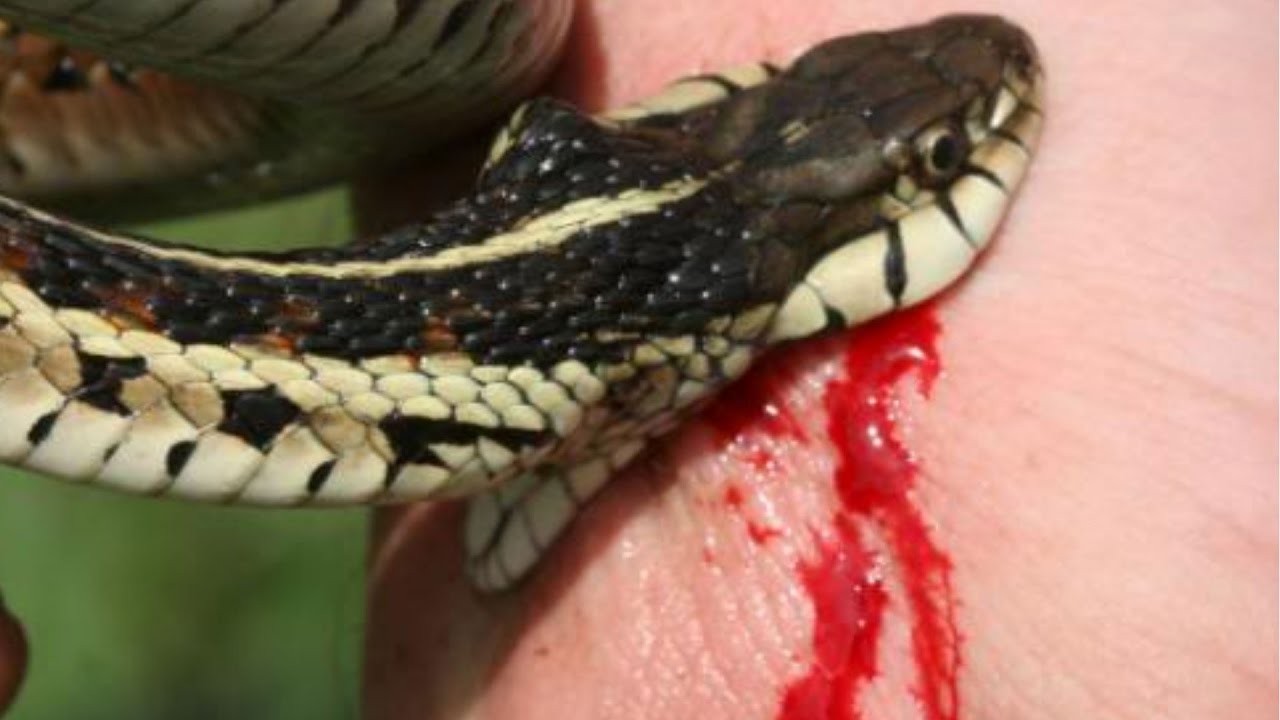 Snake-Bite-1530527384.jpg