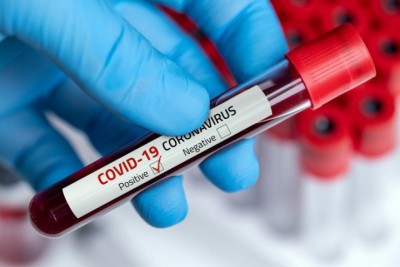 Coronavirus-Blood-Test-77-1598929060.jpg