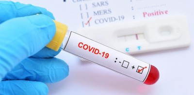 corona-virus-covid-19-tes-1641989188.jpg