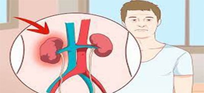 kidney-pidit-1649292376.jpg