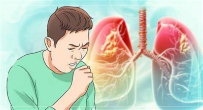 Tubercolosis-1742795491.jpg